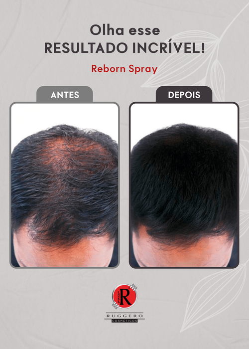 Reborn Tônico Capilar Spray Ruggero Cosméticos-60ml