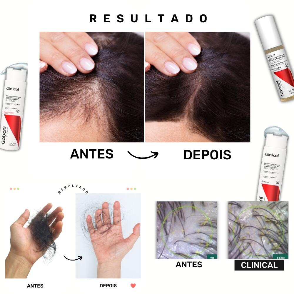 Gaboi Comprar Cronograma Capilar - Cabelos Recuperados em Menos de 4 semanas ...