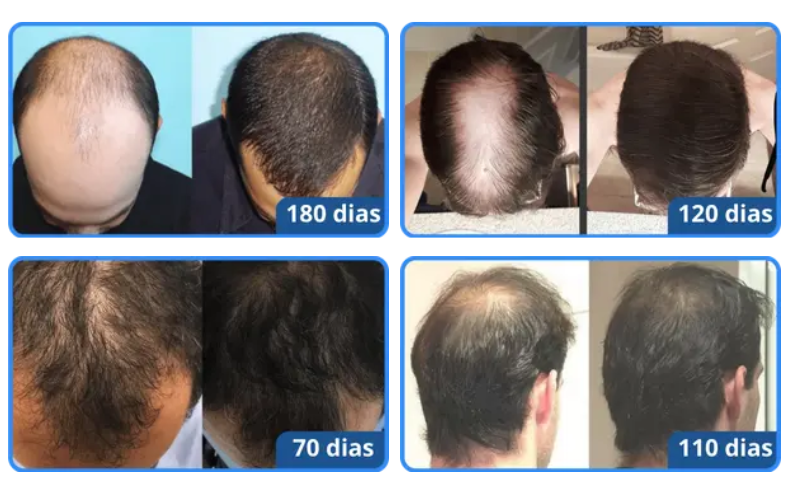 design-sem-nome-10-1-66d8880f6ce661.png