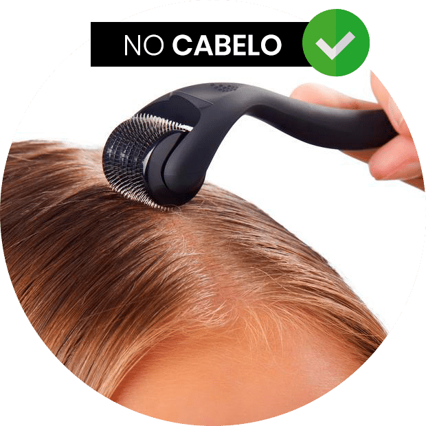 no-cabelo--66e05f79793a01.png