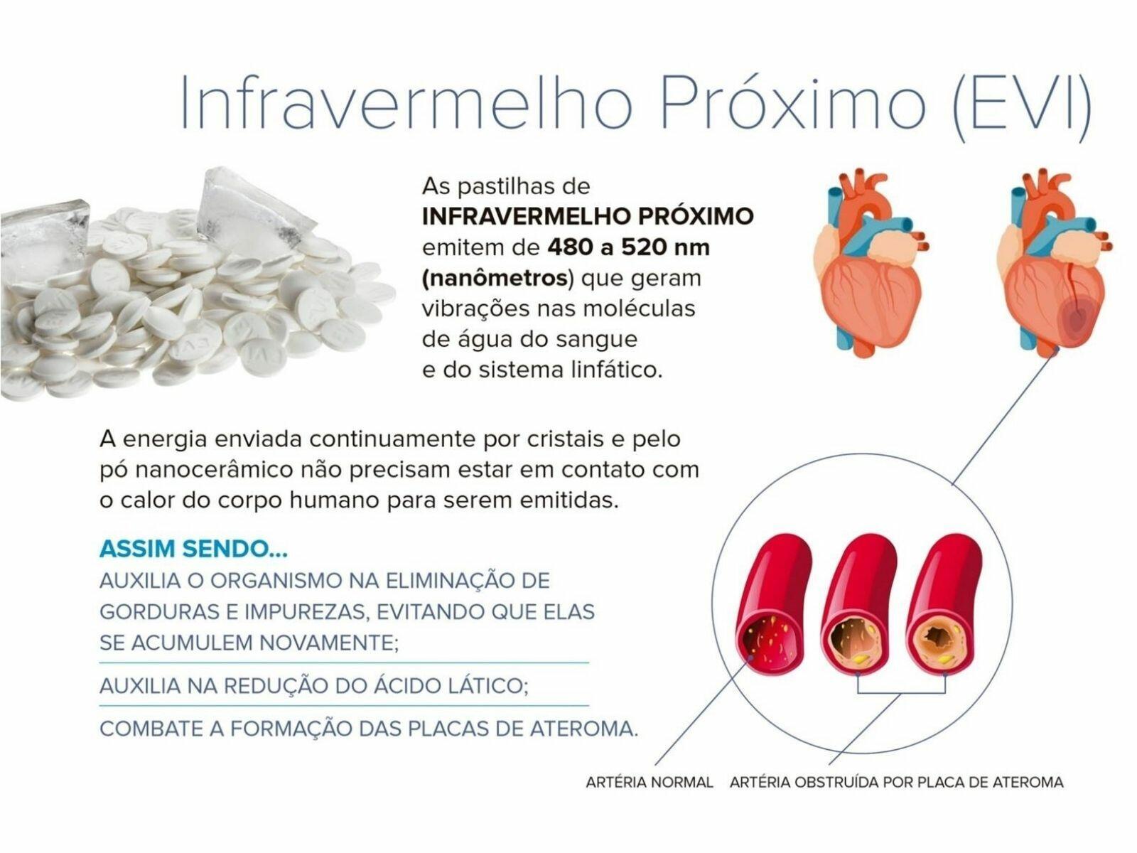 Colchão Magnético Ônyx Europillow - 25cm de Altura